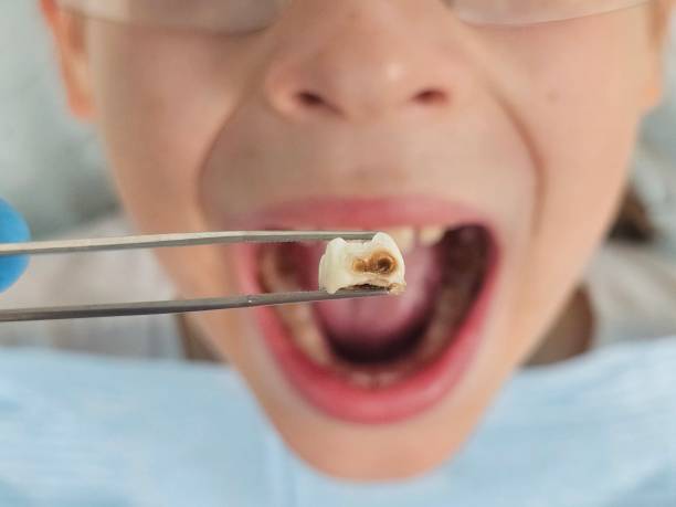 Best Emergency Care for Gum Disease in Fellsburg, PA